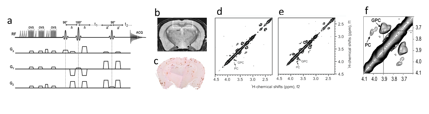 Fig. 1. (a) 2D L-COSY pulse sequence, (b) Voxel position in cortex/hippocampus of mouse brain for MRS. (c) Amyloid-plaque measured by immunohistology. (d) 2D MRS data from WT and (e) AD mouse. (f) Separation of GPC and PC is shown in enlarge view. Get